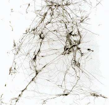 Couverture DEMENTIA de Jesse ZUBOT