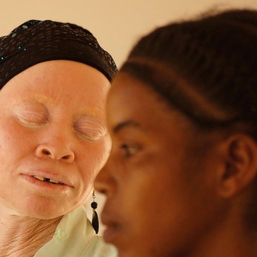 Tanzania Albinism Collective - White African Power