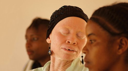 Tanzania Albinism Collective - White African Power